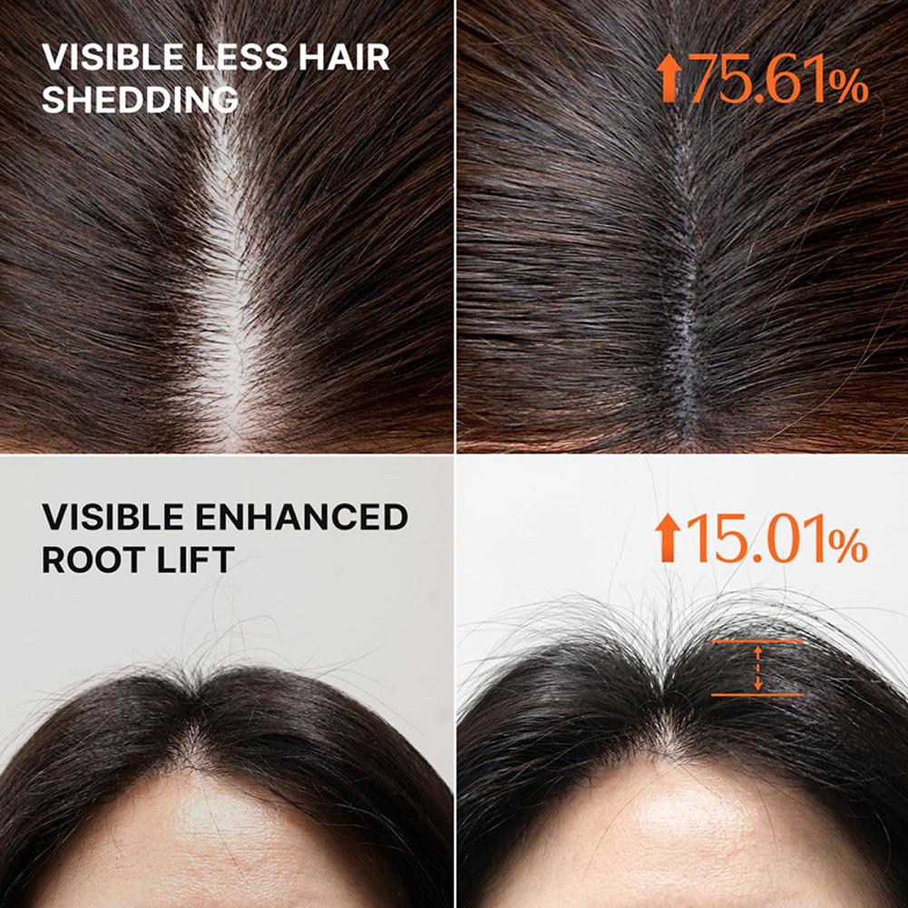 GROW:TURN Shampooing Volumisan - Hair Care For Hair Fall avis et prix