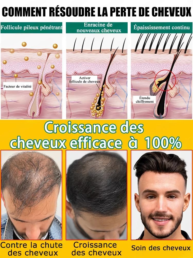 Liquide nourrissant pour le cu - Hair Care For Hair Fall avis et prix